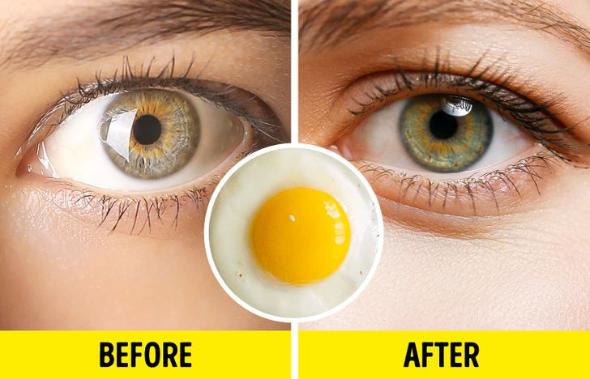 چگونه مژههای پرپشت و خیره کننده داشته باشیم؟ افزایش ضخامت مژه با تخم مرغ