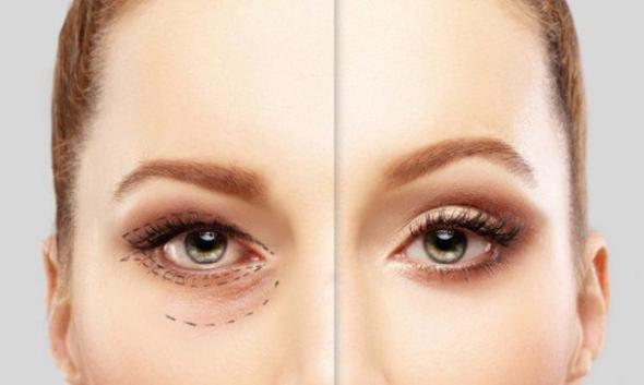 معایب لیفت ابرو