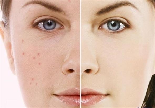 10 روش معجزهآسا برای پاکسازی پوست صورت پاکسازی صورت چیست