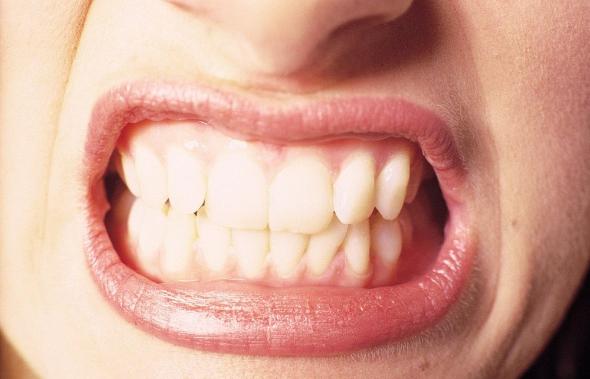دندان قروچه بزرگسالان