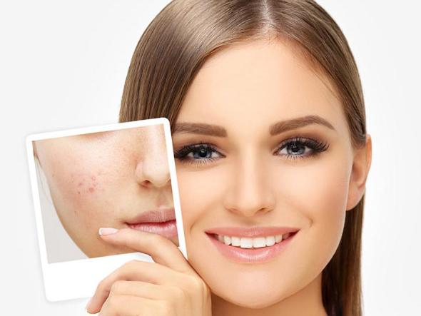 عرق هل برای پوست عرق هل برای پوست