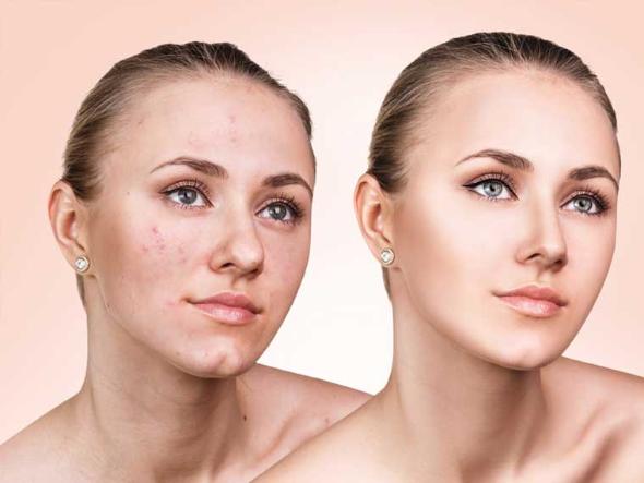 پوست صورت خود را آبرسانی می کنید؟ دهیدراته شدن پوست