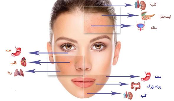  جوش صورت نشانه چیست