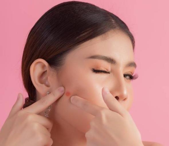 ماسک خانگی برای رفع جوش